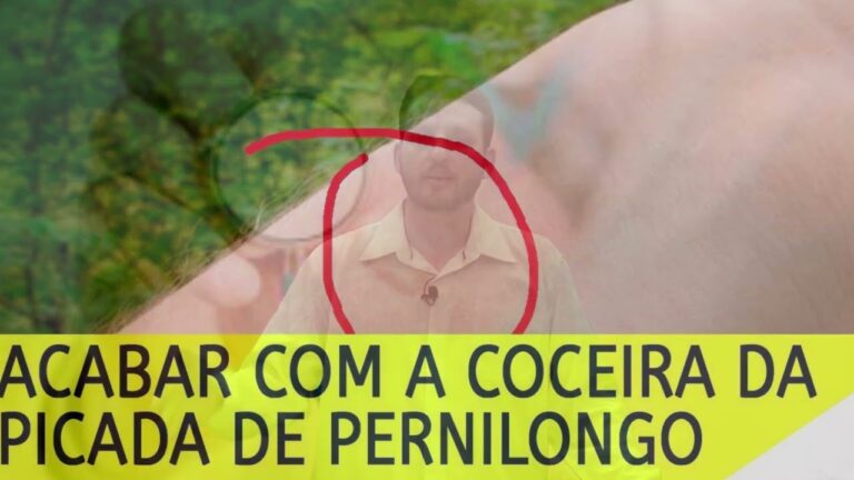 Entendendo a Alergia à Muricoca: Causas e Tratamentos