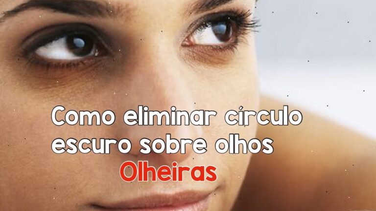Causas e Soluções para os Círculos Escuros Abaixo dos Olhos
