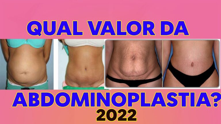 Custo Médio da Abdominoplastia: Fatores e Expectativas
