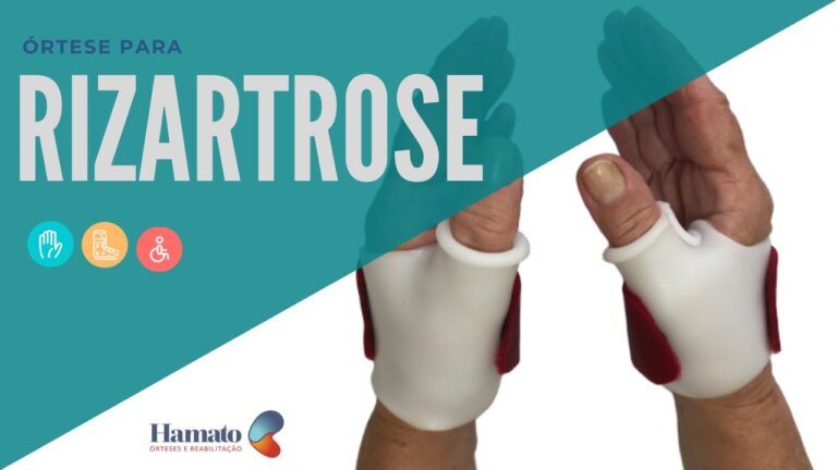 Luvas Ideais para Aliviar a Rizartrose