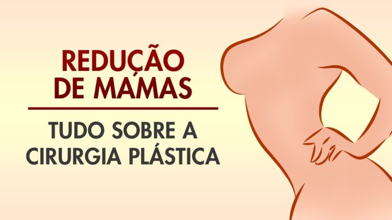 Cirurgia de Redução de Mama: Benefícios e Considerações