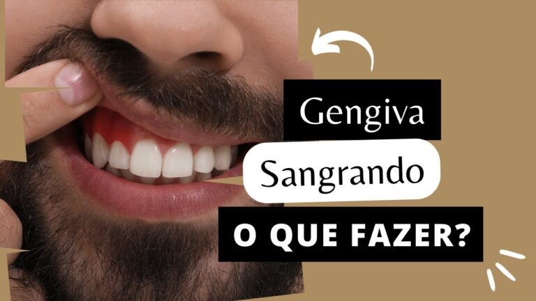 Como Tratar Gengiva Sangrando ao Escovar