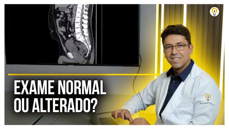 Tomografia: A Chave para Detectar Hérnia de Disco