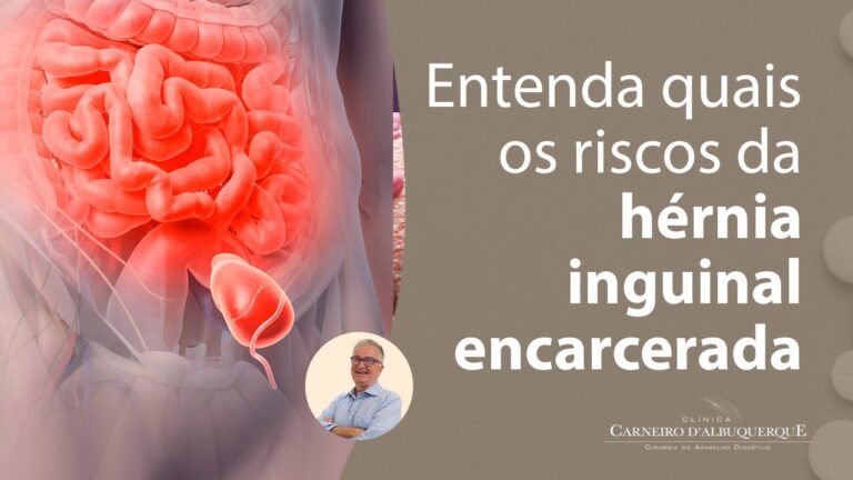 Sintomas da Hérnia Inguinal Encarcerada