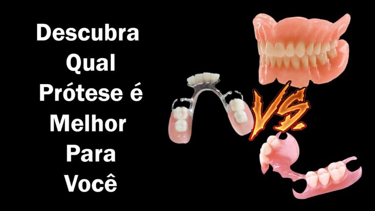 Tipos de Prótese Dentária Removível: Guia Completo