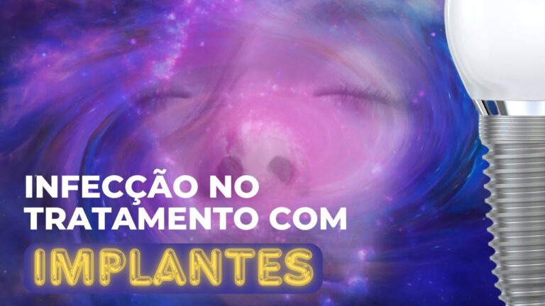Pus no Implante Dentário: O Que Fazer?