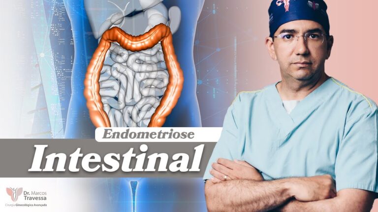 Endometriose e Sangue nas Fezes: Entenda a Conexão