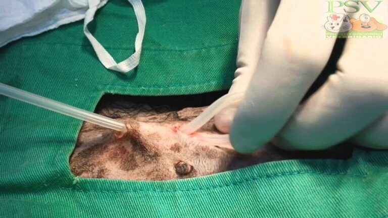 Cateter de Diálise Peritoneal: Importância e Cuidados Essenciais