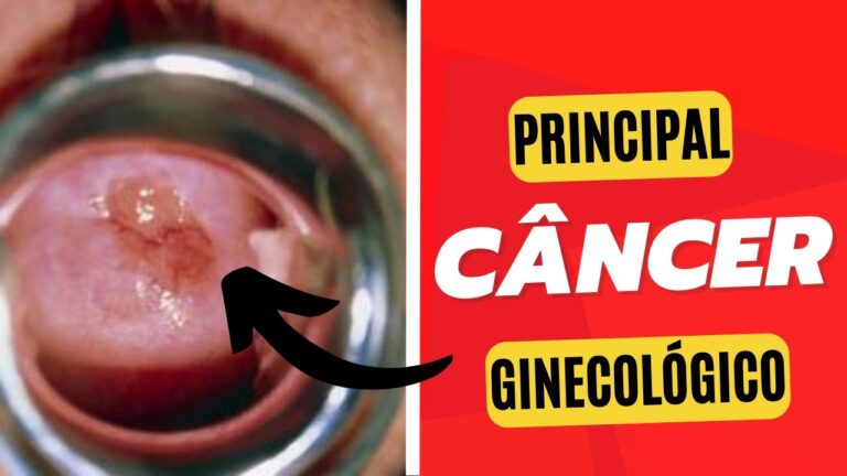 Caroços no Colo do Útero: Causas e Consequências