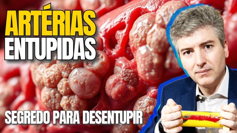 Entupimento das Veias da Perna: Causas e Soluções