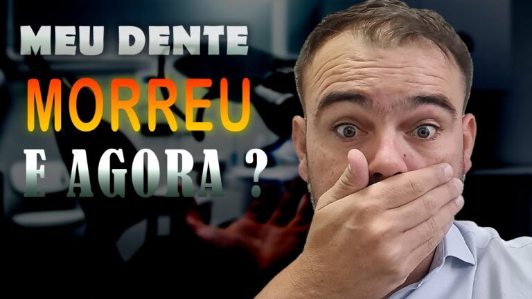 Entendendo o Nervo do Dente Morto: Causas e Tratamentos