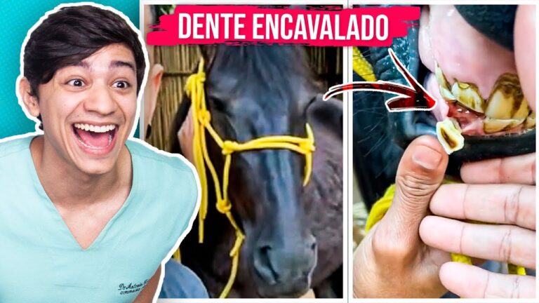 Correção do Dente da Frente Encavalado: Opções e Tratamentos