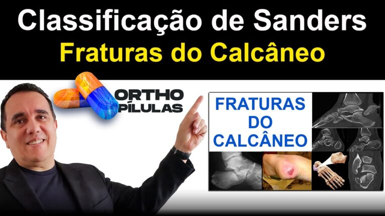 Classificação da Fratura de Calcâneo: Tipos e Abordagens Clínicas