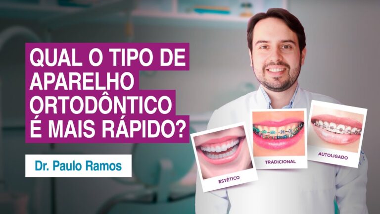 Qual Aparelho Ortodontico Proporciona Resultados Mais Rápidos?