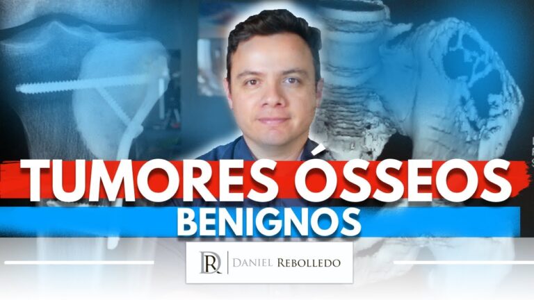 Tumor Benigno no Pé: Causas e Tratamentos