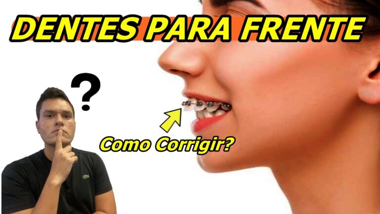 Avanço dos Dentes Superiores: Causas e Soluções