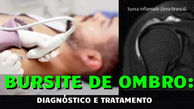 Água no Ombro: Causas e Soluções Eficazes