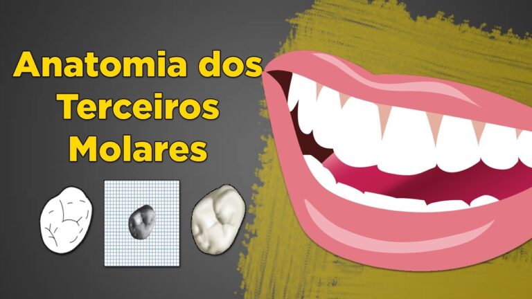 Impacto da Extração dos Dentes 38 e 48 na Saúde Bucal