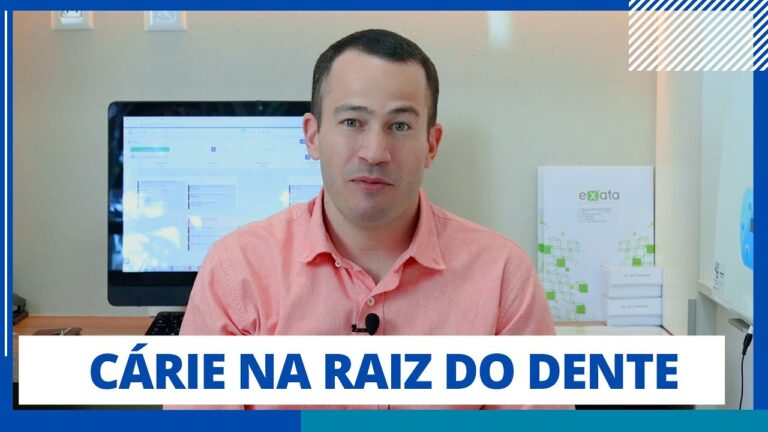 Radiografia da Cárie na Raiz do Dente: Diagnóstico e Tratamento