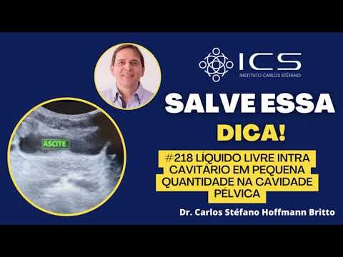 Liquido na Cavidade Endometrial: Causas e Implicações