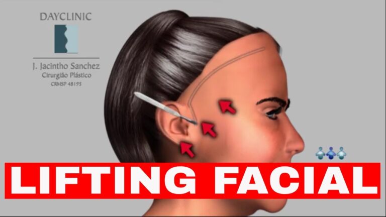 Elevando o Valor Facial: T&eacute;cnicas e Benef&iacute;cios