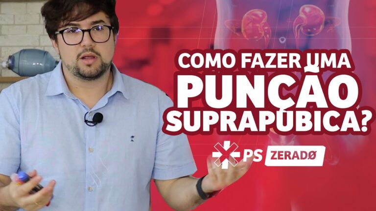 Entendendo a Região Supra-Púbica: Anatomia e Funções