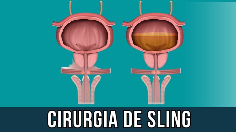 Superando a Incontinência Urinária Após Cirurgia de Períneo