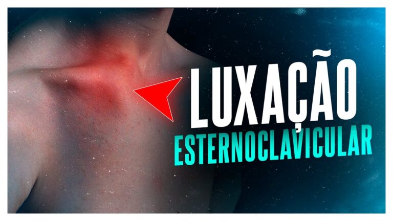 Sintomas da Luxação Esternoclavicular: Identificação e Tratamento