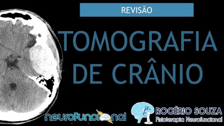 Tomografia do Crânio: Como é Realizada?