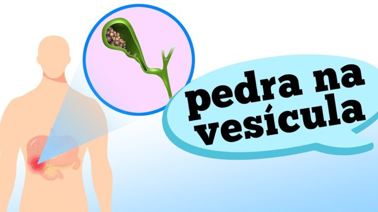 Entendendo os Problemas na Bile: Causas e Soluções