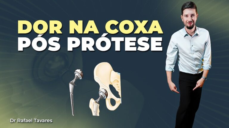 Gerenciamento da Dor na Coxa Após Artroplastia de Quadril