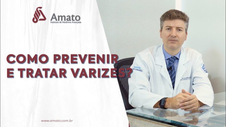 Dicas Eficazes para Evitar Varizes