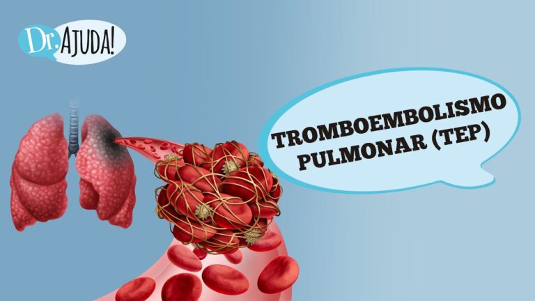 Dispositivos Médicos Inovadores no Tratamento da Embolia Pulmonar