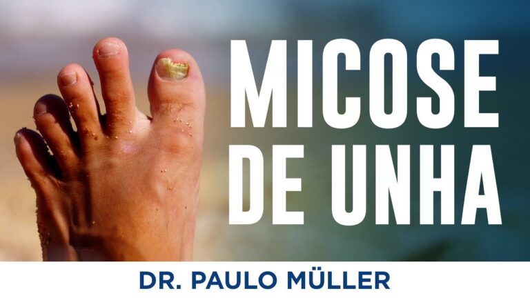 Escolhendo o Médico Especialista em Unhas Ideal