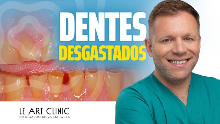 Transformação de Dentes Desgastados: Antes e Depois