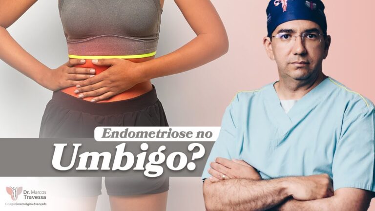 Endometriose Umbilical: Imagens e Casos Clínicos