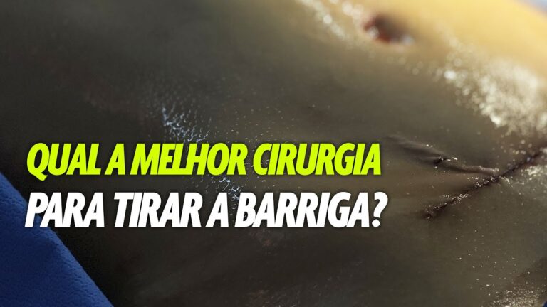 Cirurgia para Reduzir Barriga: Tudo que Você Precisa Saber