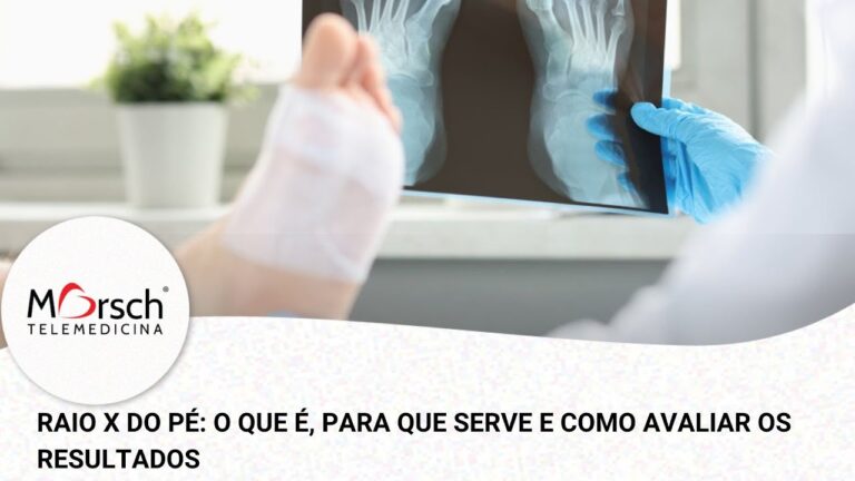 Raio X de um Pé: Análise e Importância na Saúde Podal