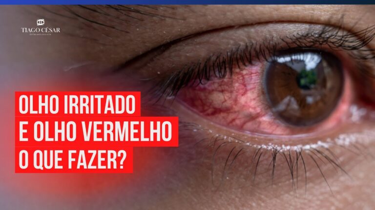 Causas e Solu&ccedil;&otilde;es para Olhos Irritados