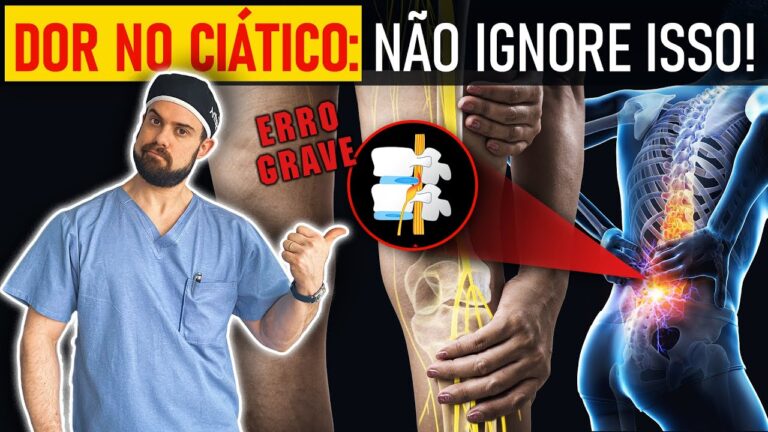 Nervo Ci&aacute;tico: Ortopedista ou Neurologista?