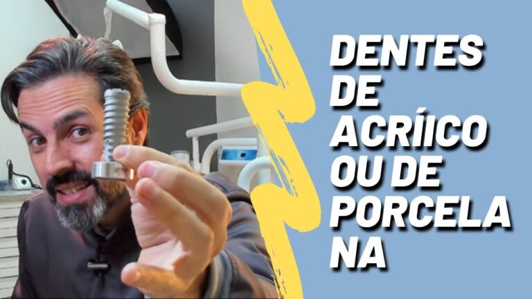 Inspiração em Prótese de Acrílico: Galeria de Fotos