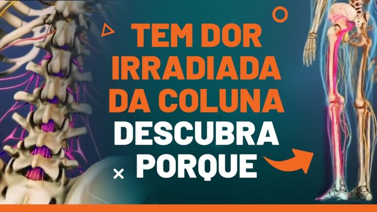 Causas e Tratamentos da Dor Irradiada na Perna