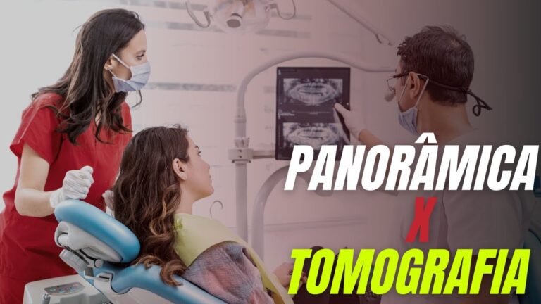 Custo da Panorâmica Dental: O que Você Precisa Saber