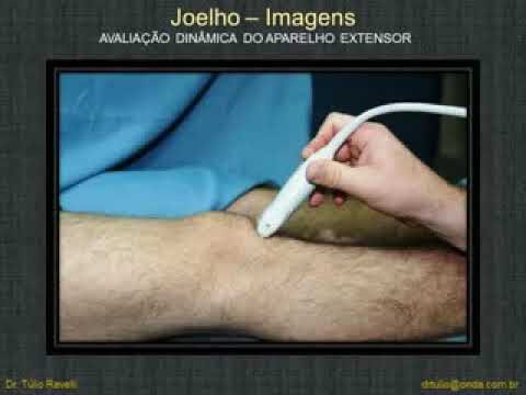 Ultrassonografia do Joelho: Para Que Serve?