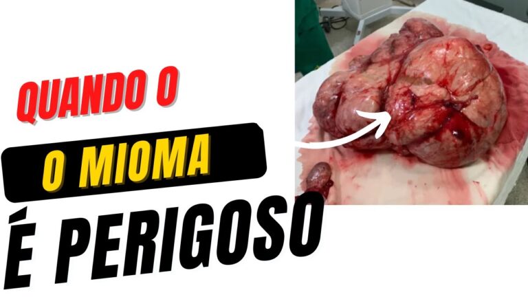 Entendendo o Mioma Intramural de 1 cm: Causas e Tratamentos