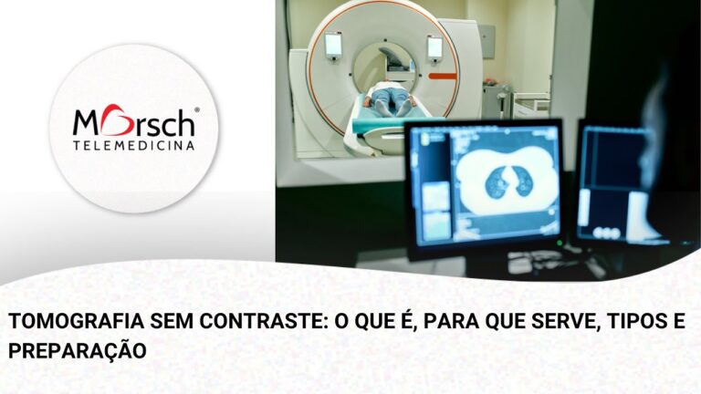 Tomografia Abdominal Sem Contraste: Benefícios e Indicações