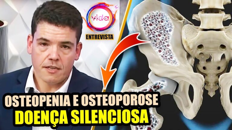 Osteopenia e Sua Relação com a Dor nas Costas