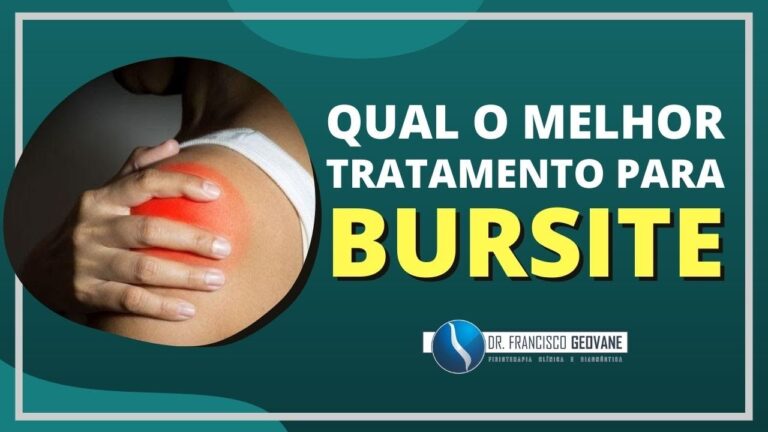 Tratamento Eficaz para Bursite Subacromial