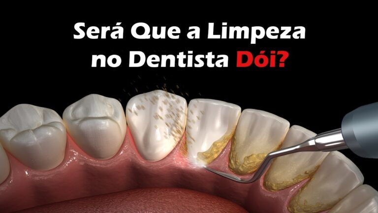 Como é Feita a Limpeza nos Dentes