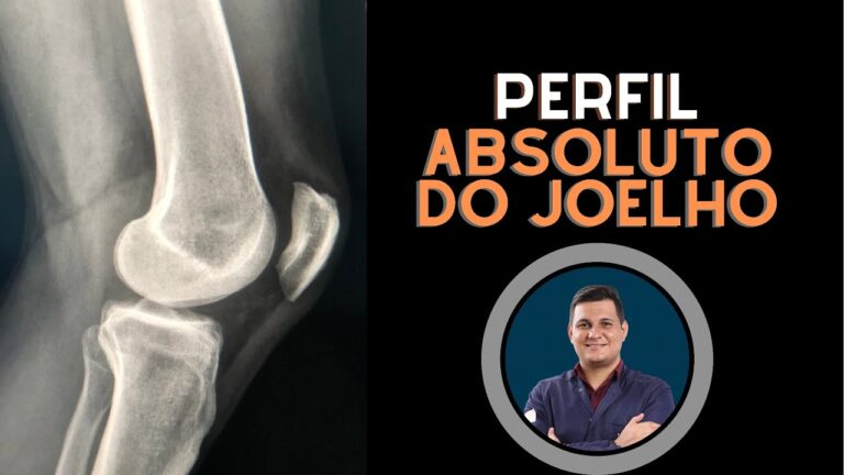 Preço do Raio X de Joelho: O Que Você Precisa Saber